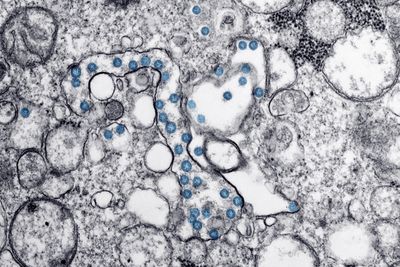 Archaea Utilize CRISPR-Cas Systems as Adaptive Immune Memory Against Viruses