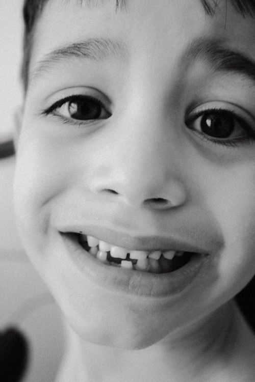 Free Black and white close-up of a child smiling, showcasing missing front tooth. Stock Photo