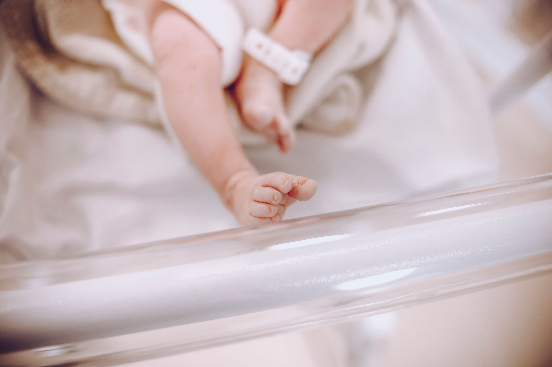 Tratamento de icterícia neonatal em Guarulhos