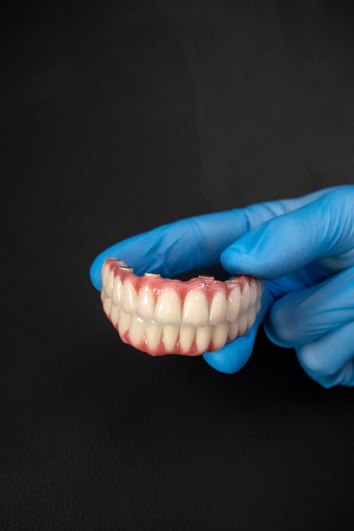 Free Dental prosthetics held by a gloved hand on a black background, showcasing dentistry tools. Stock Photo