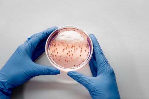 Free Petri Dish with Live Bacteria Stock Photo