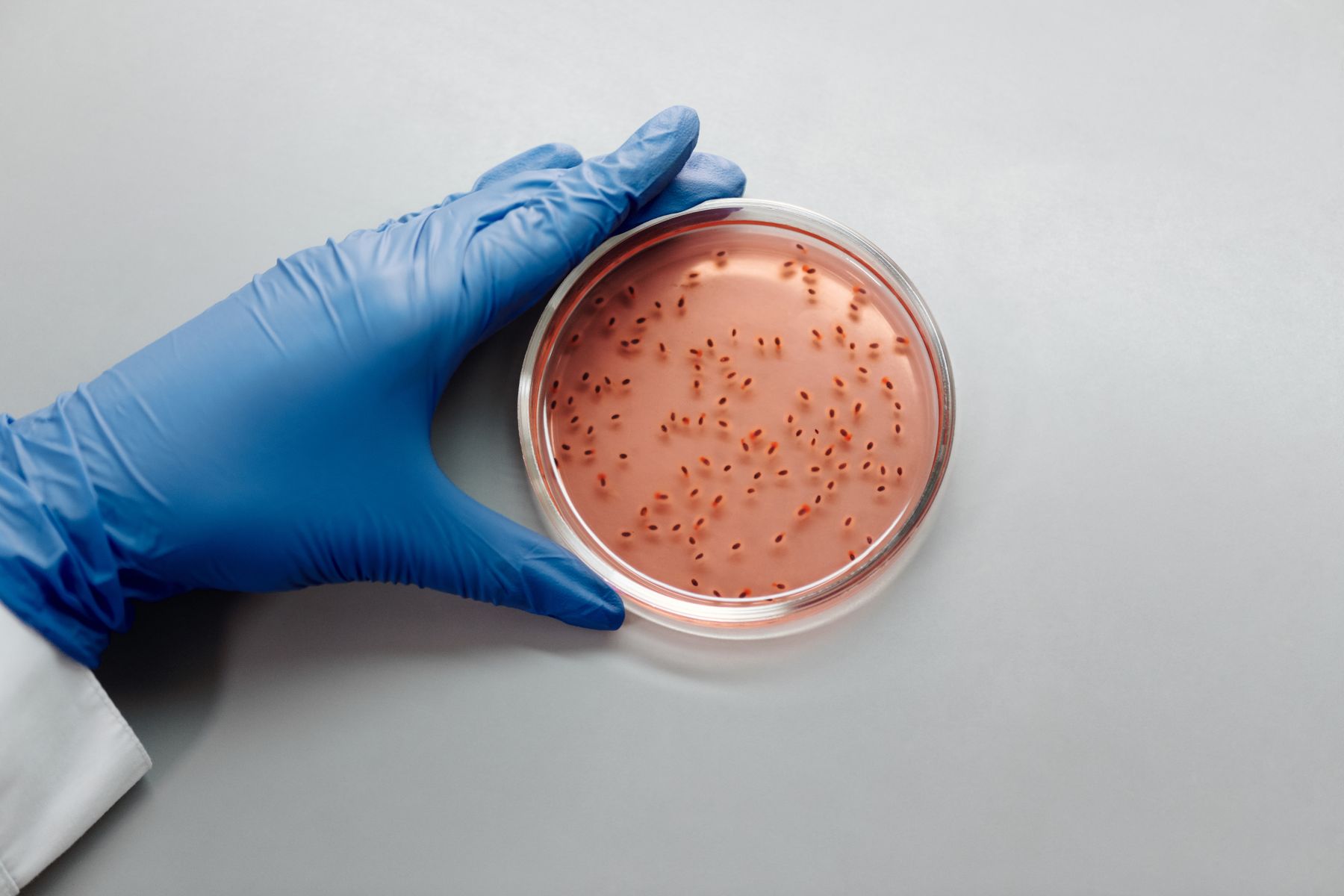 Food Pathogen Testing: Culture, qPCR and Rapid Molecular Workflows