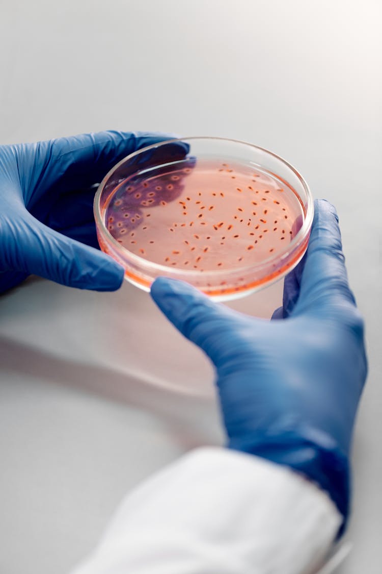 Person Holding A Petri Dish