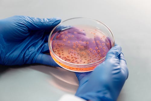 Free Person Holding a Petri Dish with Live Specimen Stock Photo