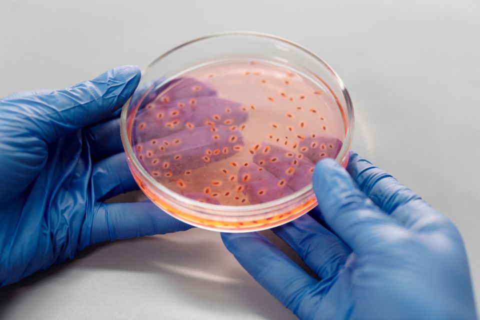 Culture plates showing microbial colonies