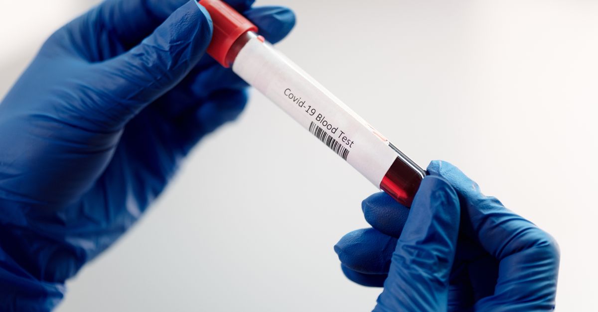 Molbio Diagnostics IPO: A High-Risk Bet for Long-Term Growth?
