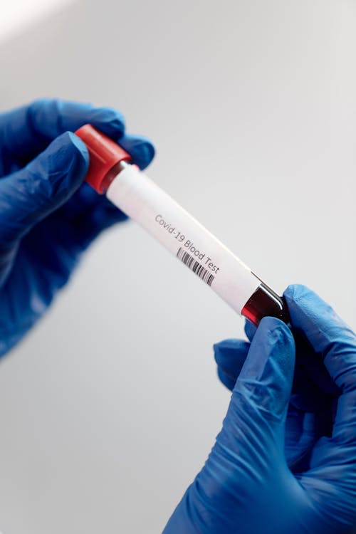 Free Photo of a Person's Hands Holding a Blood Test Tube Stock Photo