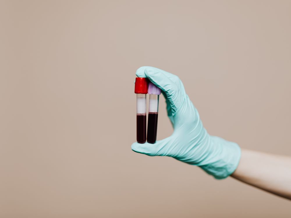 Two blood sample tubes held in a lab