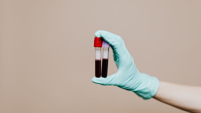 Two blood sample tubes held in a lab