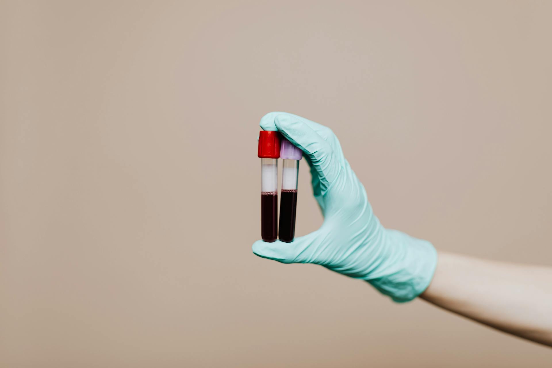 Photo Of Person Holding Test Tubes