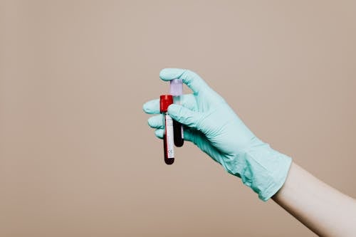 Free Photo Of Person Holding Test Tubes Stock Photo