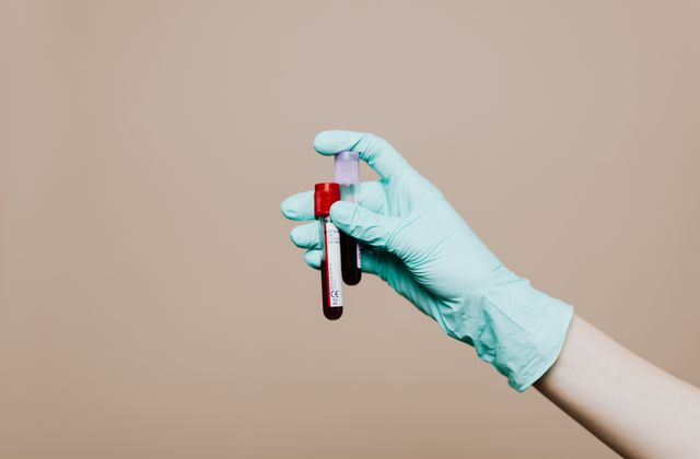 Gloved hand holding blood sample tubes