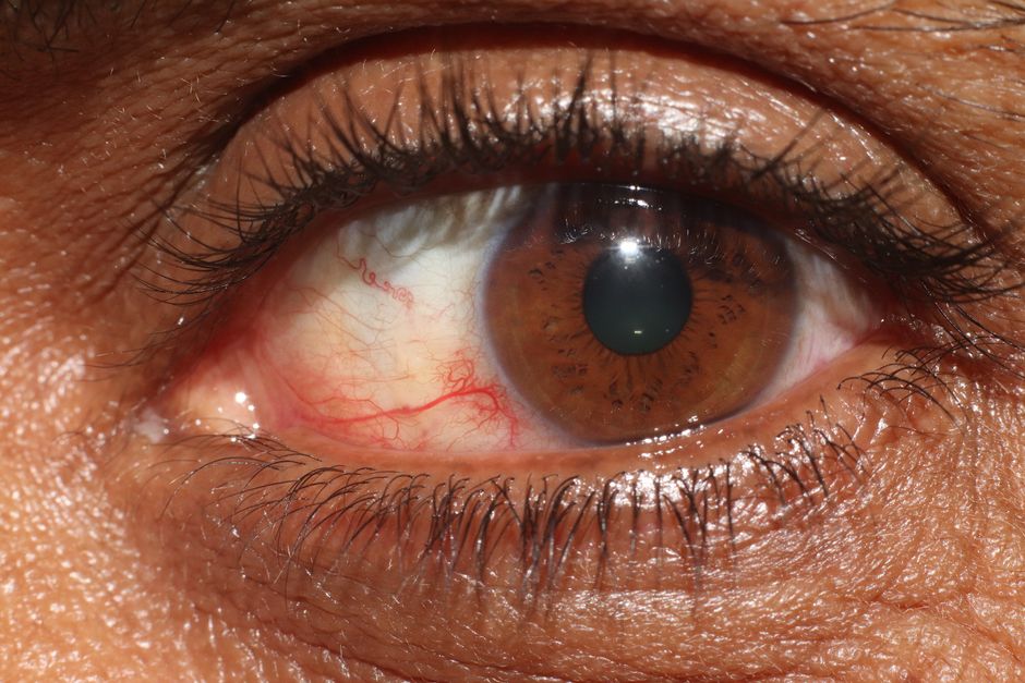 Detailed shot of an eye showcasing the iris, eyelashes, and blood vessels.