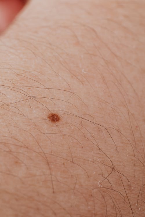 Free Close-up View Of A Person's Skin Stock Photo