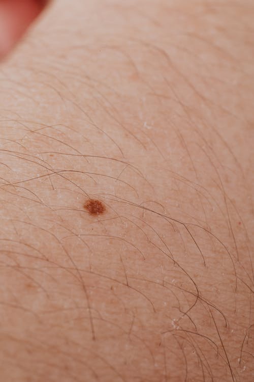 Close-up View Of A Person's Skin