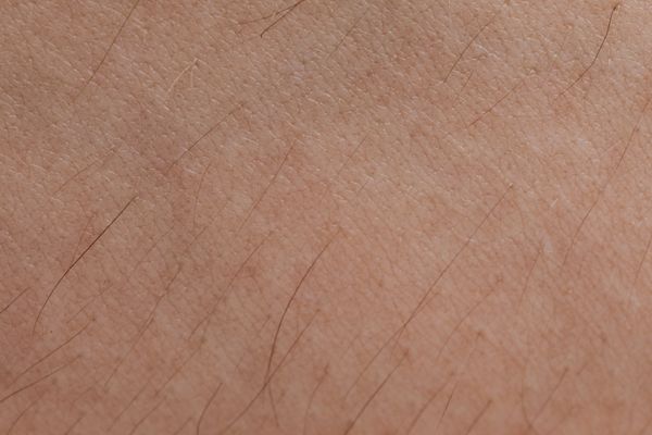 Advanced exosome cellular hair regrowth therapy in Andheri West