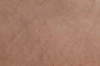 Skin and follicle close-up