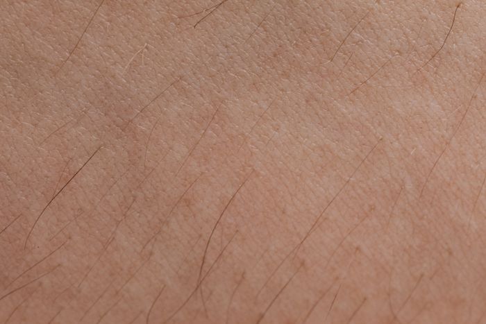 Close-up skin detail relevant to pigmentation discussion