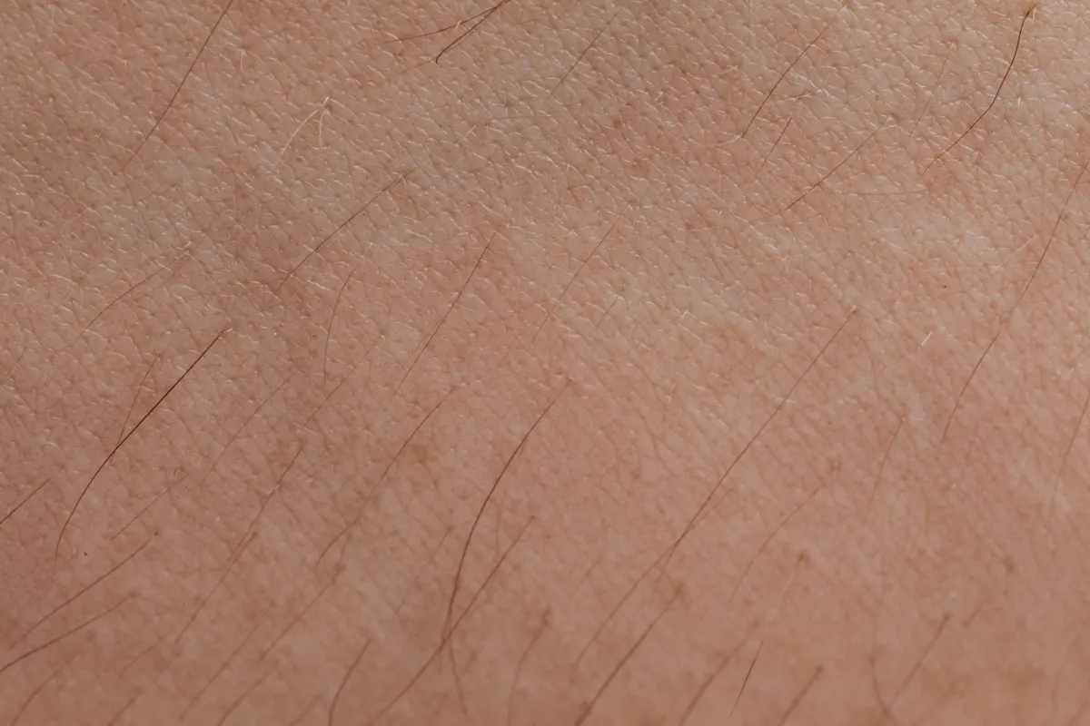 Nahaufnahme der Haut, die nach einer Behandlung wie Microneedling gegen Aknenarben gepflegt wird.