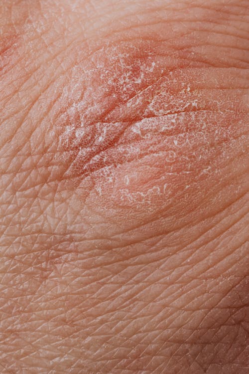 Kostenloses Stock Foto zu behandlung, dermatologie, epidermis