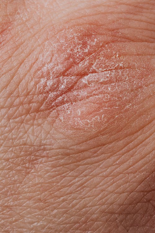 Free Close-up View Of Human Dry Skin Stock Photo