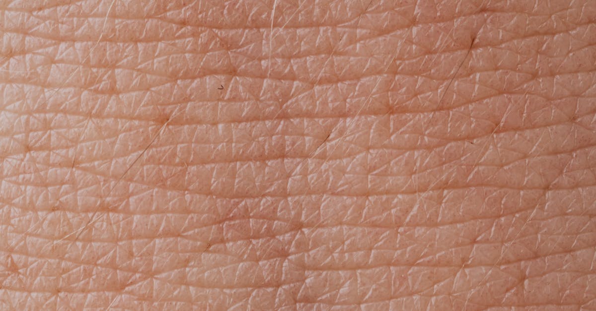 Close-up View Of Human Skin