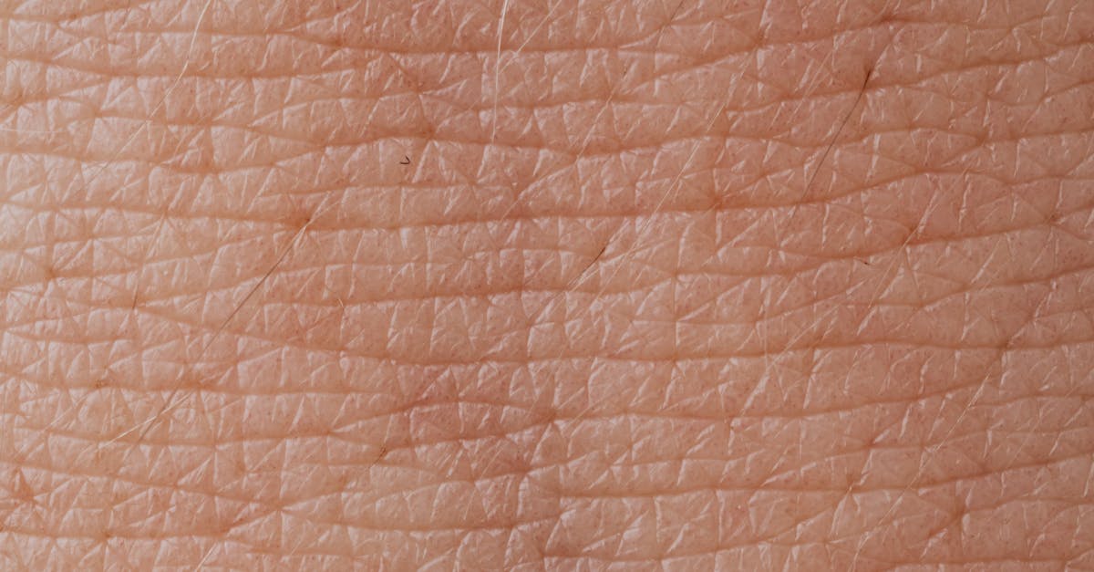 Close-up View Of Human Skin