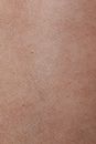 Close-up View Of Human Skin