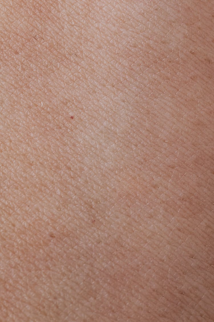 Close-up View Of Human Skin