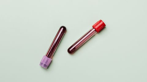 Blood samples in test tubes on a light background, ideal for medical and laboratory themes.