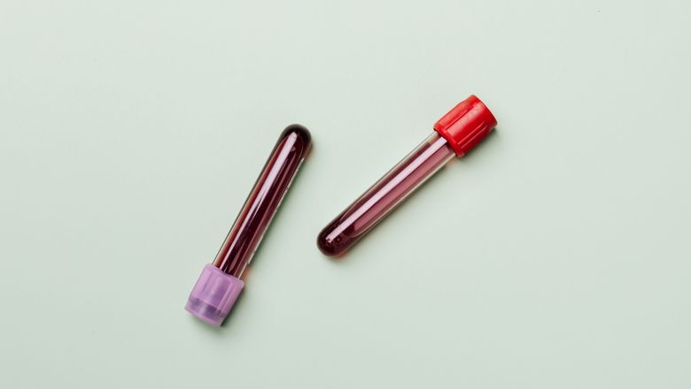 Blood samples in test tubes