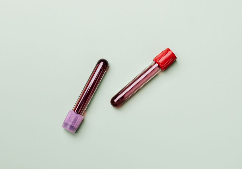 Blood Testing