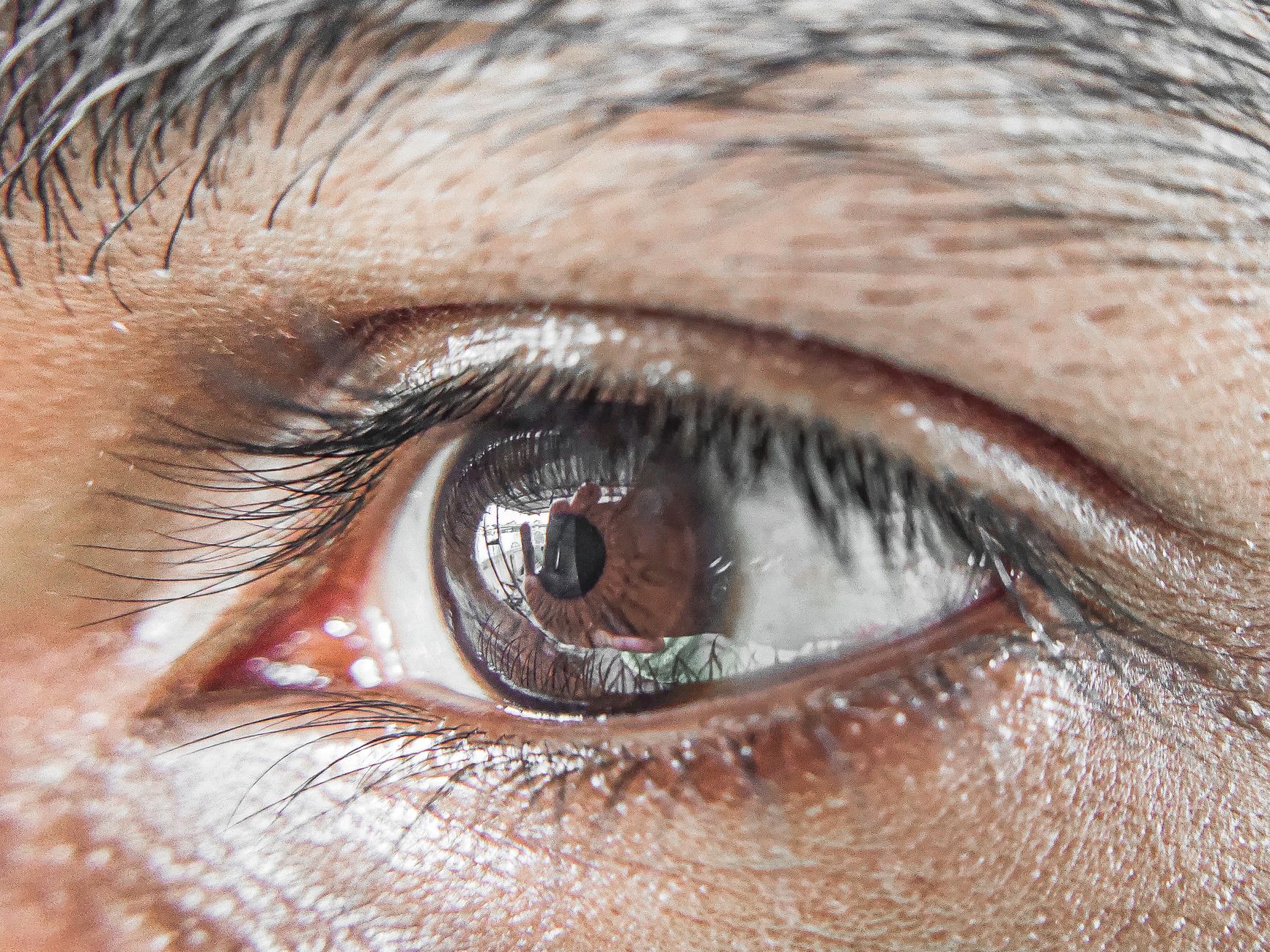 Understanding Geographic Atrophy: Risks and Prevention