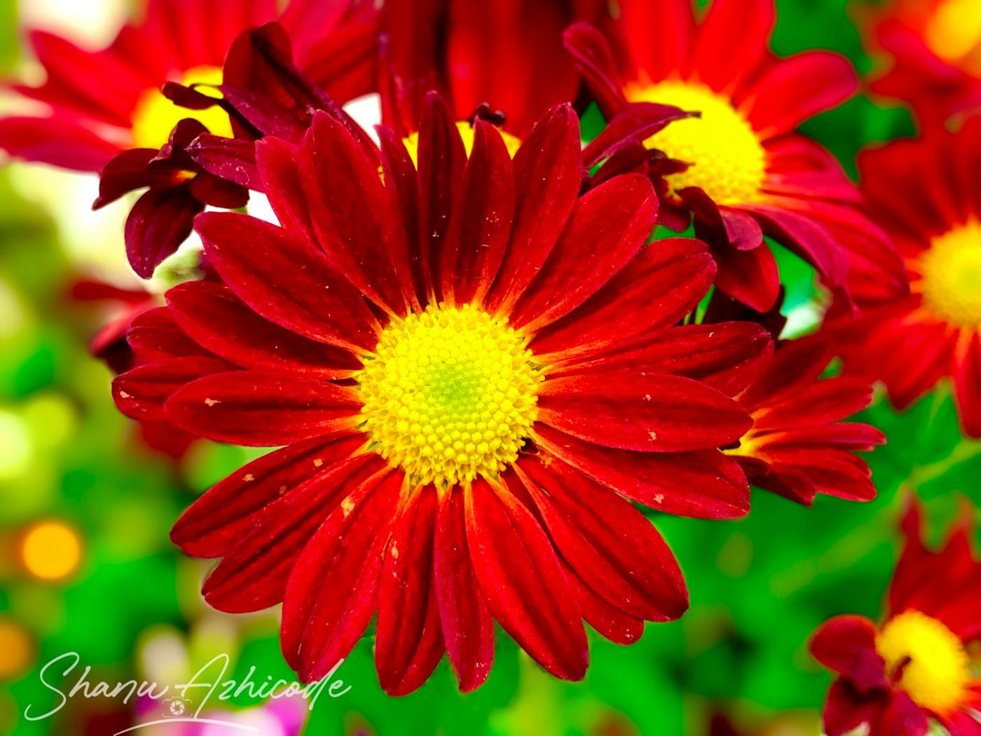 Người mệt mỏi vì thiếu dinh dưỡng