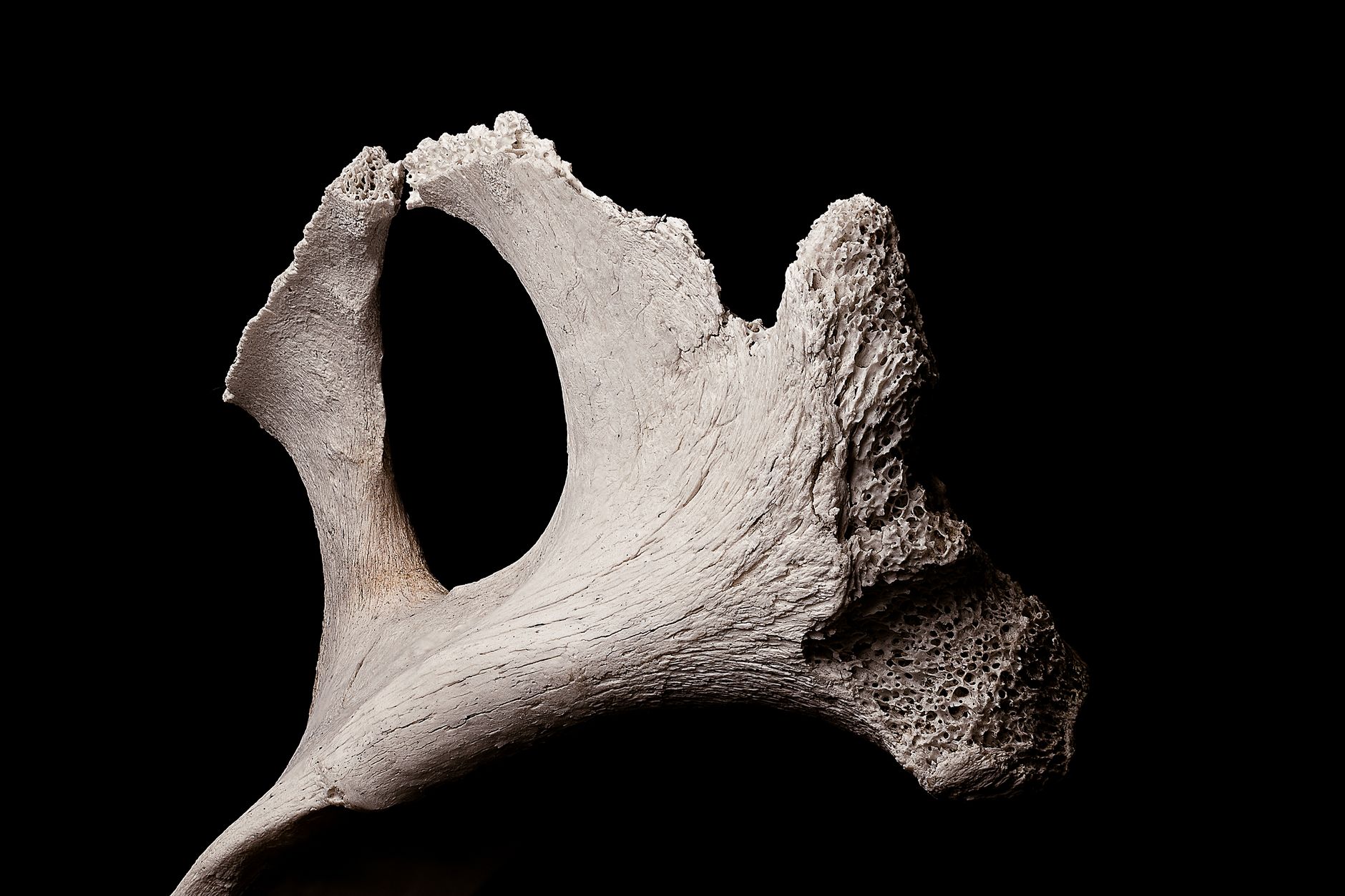 Calcium and Vitamin D: Your Allies Against Osteoporosis