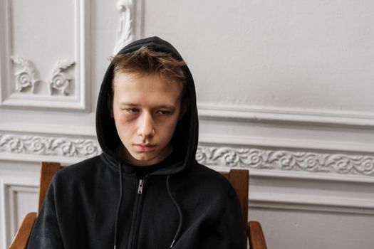 一名年轻男子穿着黑色连帽衫坐在室内，脸上有明显瘀伤，露出沉思的表情