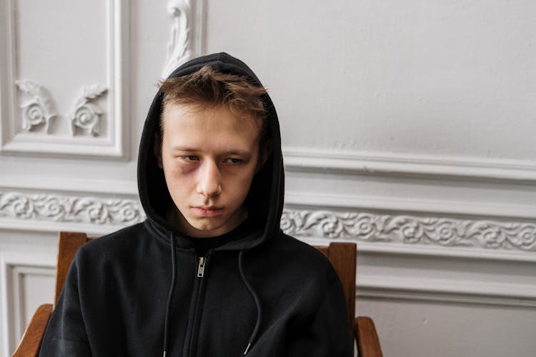 A Teenager With A Black Eye 