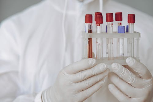 Person Holding Test Tube Rack