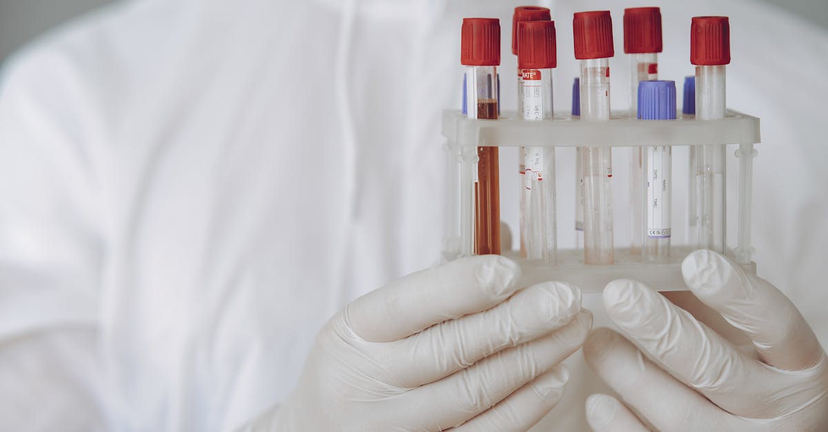 Person Holding Test Tube Rack