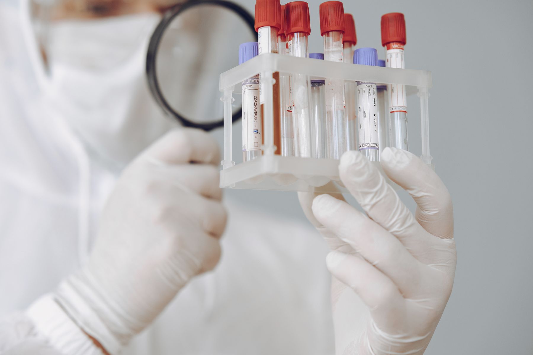 A rack of test tubes in a laboratory. Representational image.