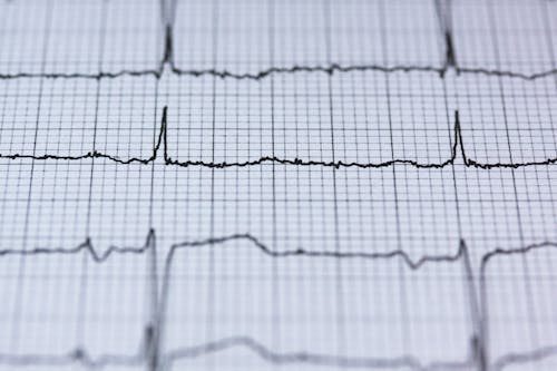 Kostnadsfri bild av data, Diagram, ecg