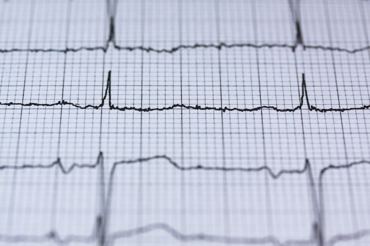 Study links high lithium in drinking water to rare heart condition in children
