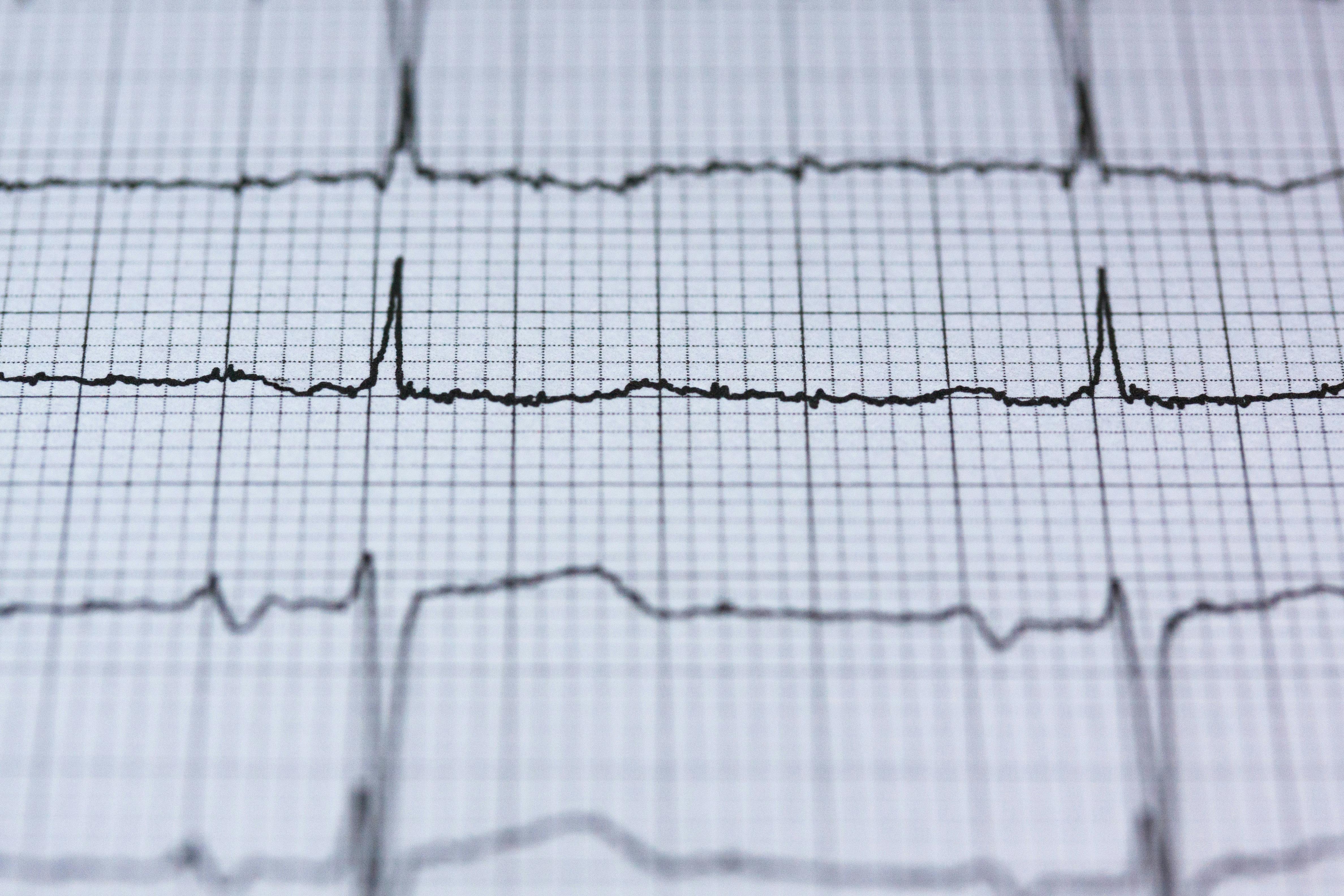 Ecg Photos, Download The BEST Free Ecg Stock Photos & HD Images