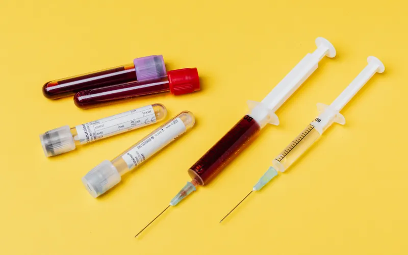 Valores normales HbA1c prediabetes diabetes tipo