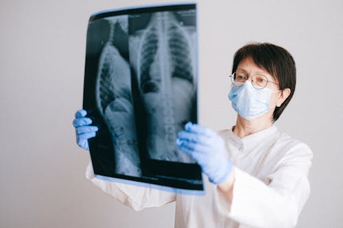 A Doctor Looking at an X-Ray Result