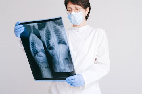 A Doctor Looking at an X-Ray Result