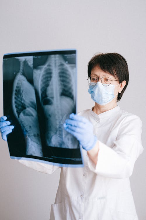 Doctor Holding a X Ray