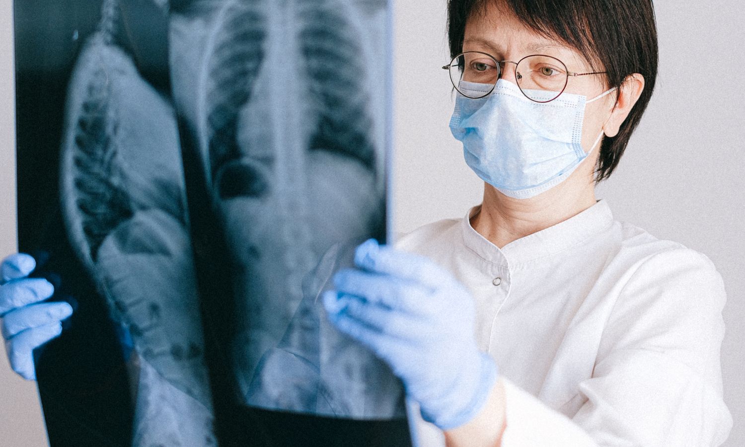 Consulta médica antes de una rinoplastia