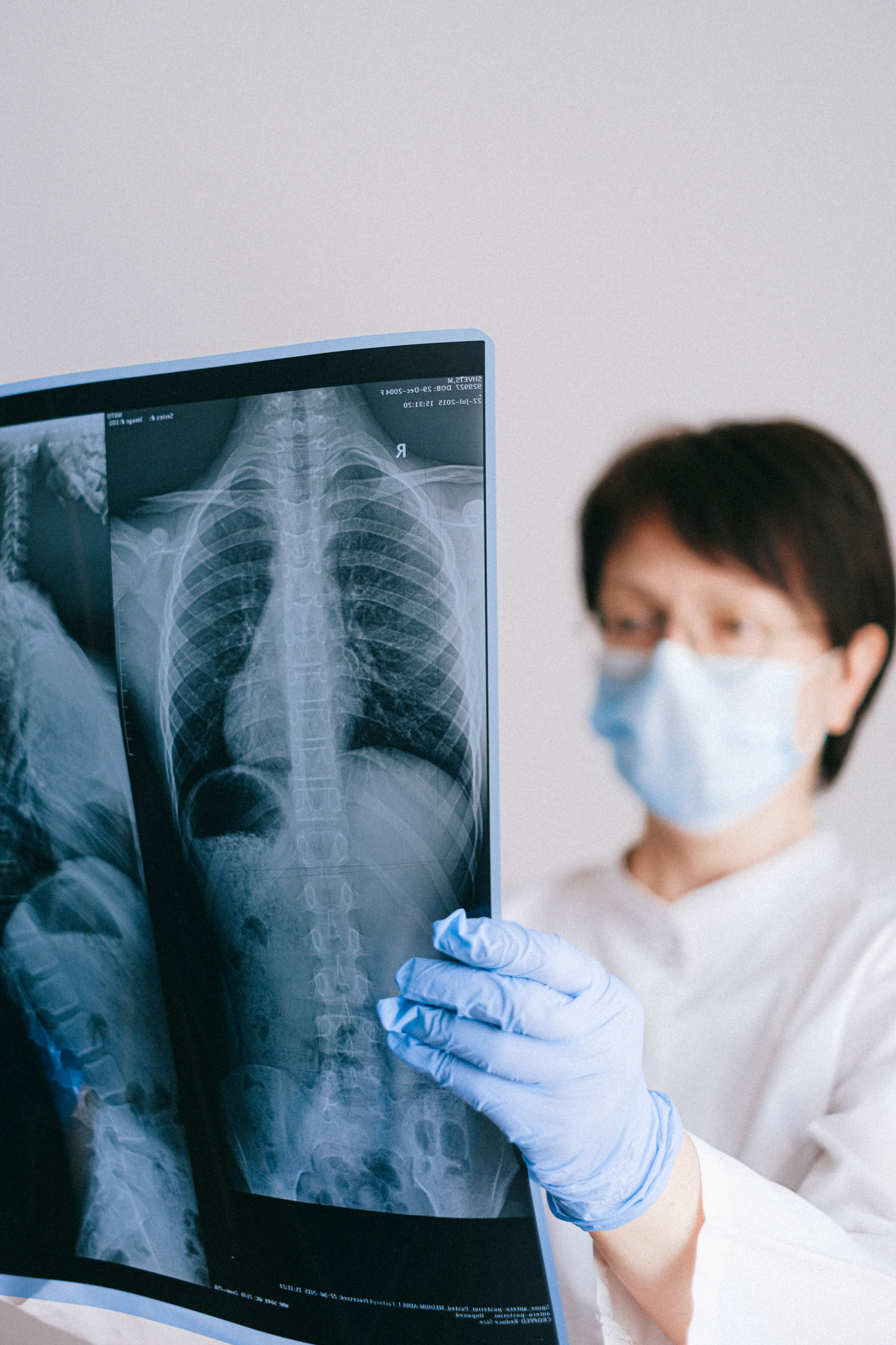 A doctor wearing a face mask examines an x-ray with concentration, displaying a medical professional's focus.