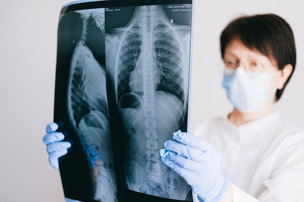 Chest X-ray on a monitor